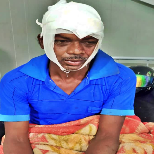 खूंटी में डायन-बिसाही के शक में दंपती पर खौफनाक हमला, टांगी से घायल हुए पति-पत्नी, पत्नी की हालत गंभीर