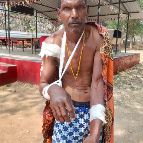 जंगली भालू के हमले से ग्रामीण घायल, इलाज के बाद मुआवजे के लिए कराया गया आवेदन